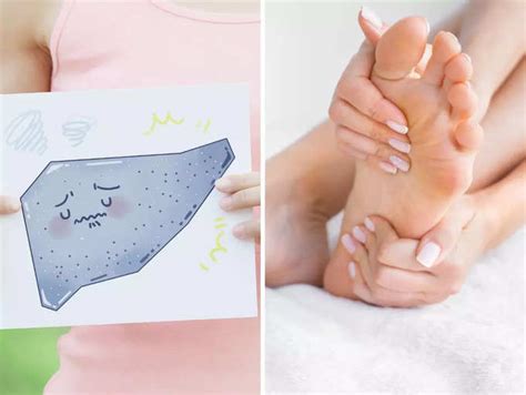 The signs in your feet that can indicate liver problem | The Times of India