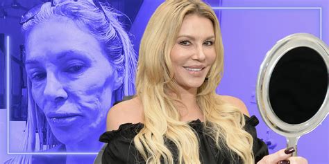 RHOBH's Brandi Glanville Blames Facial Parasites, Bravo For Shocking Selfie