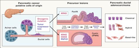 Pancreatic cancer: Advances and challenges: Cell
