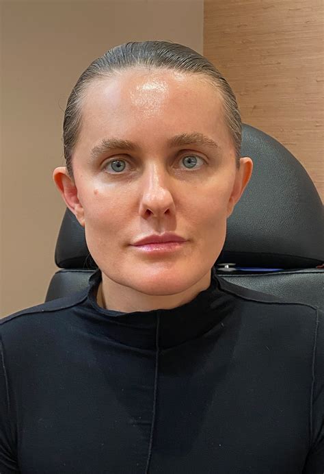 New Thread Lift 的图像结果