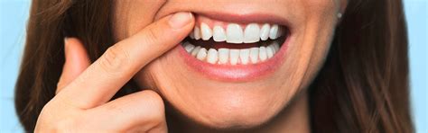 How to treat bleeding gums | Pepsodent