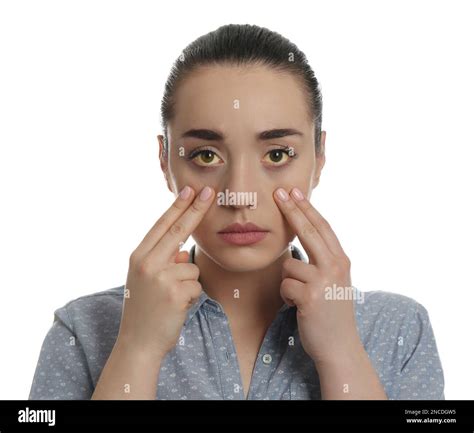 Woman checking her health condition on white background. Yellow eyes as symptom of problems with ...