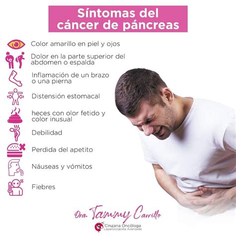 Cancer De Pancreas Sintomas Iniciales Cáncer Wikipedia, La
