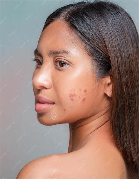 Skin blister image | Premium AI-generated image