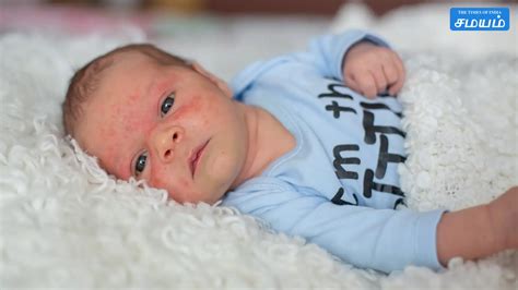 Skin Care Tips For New Born Baby,பிறந்த குழந்தைக்கு என்ன மாதிரி சரும ...