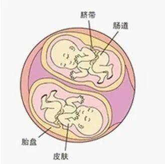 淄博市妇幼保健院：单卵or双卵双胎，你了解吗？ 孕期双胎有哪些并发症？_胎儿