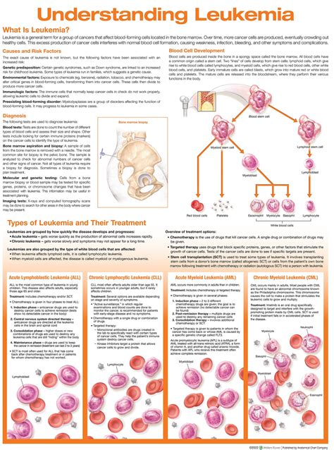 Anatomy Charts & Posters > Understanding Leukemia Anatomical Chart. Edition Second