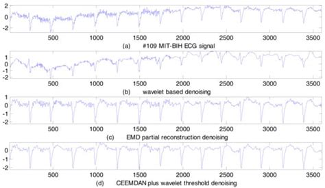 ECG Signal De-noising and Baseline Wander Correction Based on CEEMDAN ...