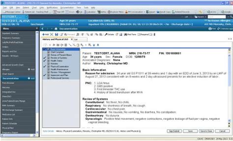 PowerChart 的图像结果