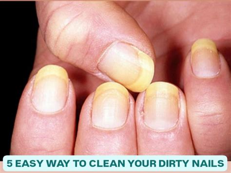 5 Easy Ways To Clean Your Dirty Nails And Maintain in just 2 minutes ...
