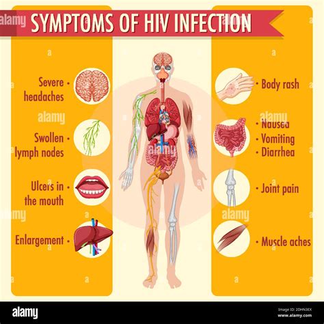 Symptoms of HIV infection infographic illustration Stock Vector Image & Art - Alamy
