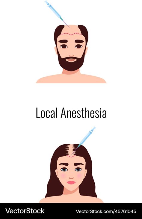 Composition of Local Anesthesia 的图像结果