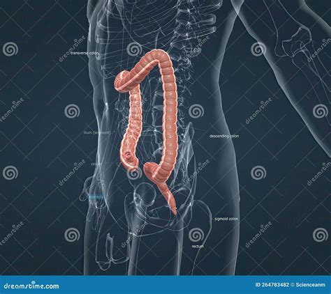 Appendicitis is a Painful Swelling of the Appendix Stock Illustration - Illustration of medicine ...