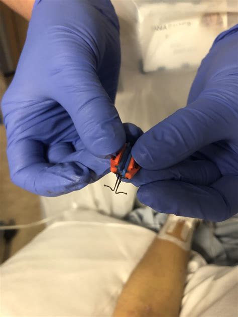 Ever see what holds your PICC line in? I call them ice climbers. And if left too long they are ...