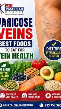 Varicose Veins: Best Foods to Eat for Vein Health | Diet Tips by Vascular Doctor