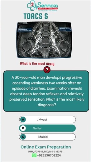 Guillain-Barré Syndrome (GBS) | MRI Findings & TOACS Case | FCPS-II, IMM, MCPS, MD/MS Preparation