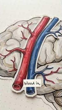 The Surprising Triggers of Brain Strokes! 🧠⚡️ #Neurology #USMLE