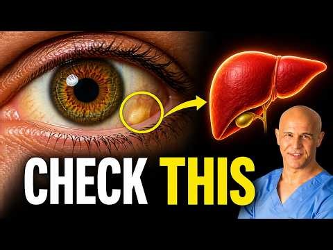 Look at Your Eyes Right Now — This Could Be a Liver Warning
