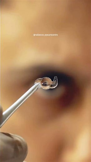 👁️ Precision matters! Watch how an intraocular lens (IOL) is carefully loaded for cataract surgery