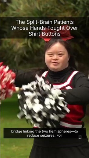 The Split-Brain Patients Whose Hands Fought Over Shirt Buttons