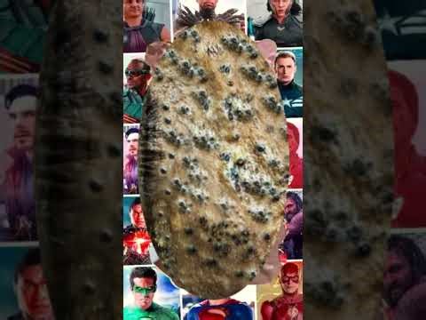 Blackheads Removal #236 | Acne Treatment and Very Satisfying Satisfying Pimple pop #blackheads