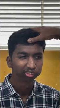 TMJoint Ankylosis patient