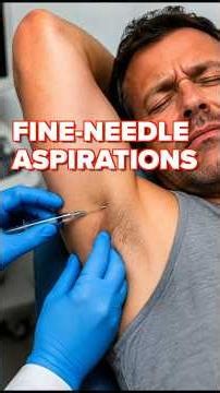 Fine needle aspirations