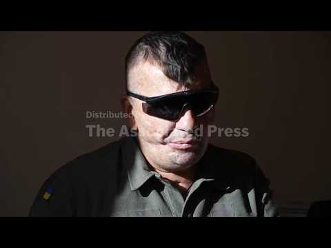 A Ukrainian soldier lost his sight in war - now he hopes to see his children again