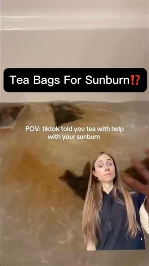 Tea Bags for Sunburn?! Dermatologist Reacts