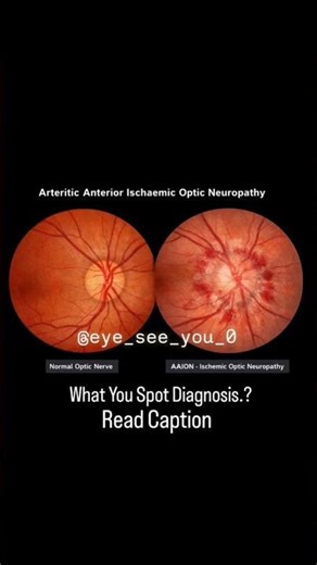 What You Spot Diagnosis.?READ DESCRIPTION FOR MORE DETAILS