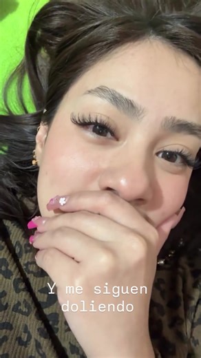 Mis dientes encimados: una reflexión emotiva