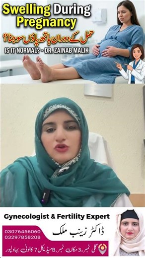 Why Does Swelling Happen During Pregnancy? | Doctor Explains#PregnancySwelling #PregnancyCare