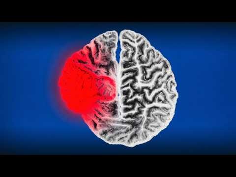 Your Brain Explodes While You Sleep. You Just Don't Know It.