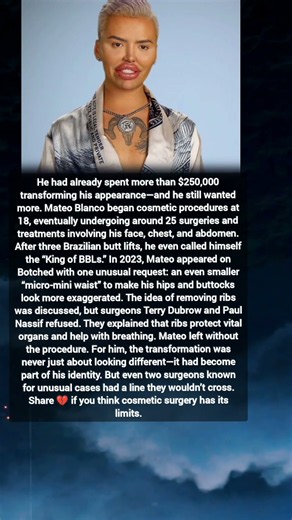Mateo Blanco Spent $250,000 on Plastic Surgery — Then Doctors Said NO 😳 | Botched