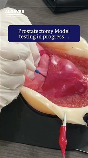 Prostatectomy Model testing