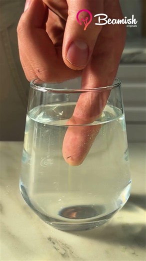 Pain free splinter removal trick #easy #splinter #removing
