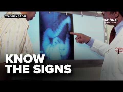 Why colon cancer is rising among younger Americans