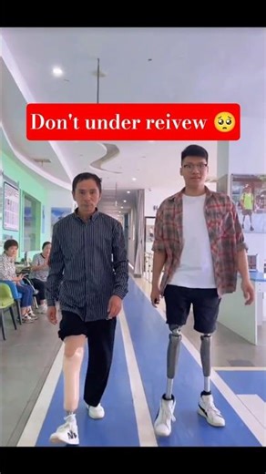 Powerful Prosthetic Journey | Never Give Up