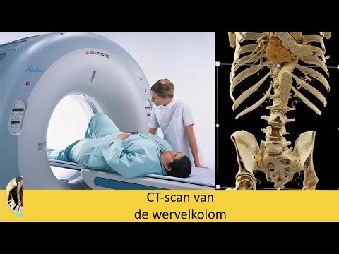 CT-scan van de wervelkolom