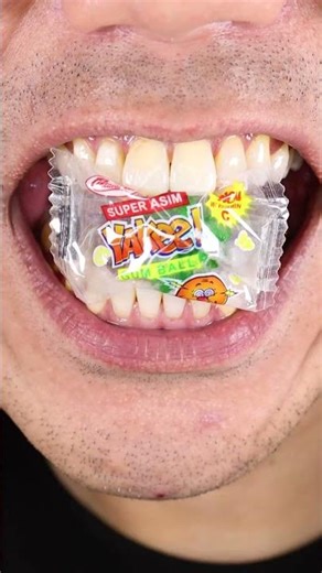 ASMR Yakee Super Asim Gum Ball 🇵🇭 90s kids' favorite super Asim Gum Ball #DoctorTristanPeh #ASMR