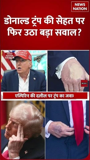Donald Trump Health Update: नीले पड़ रहे अपने हाथ के सवाल US President ट्रंप ने दिया ये Answer!