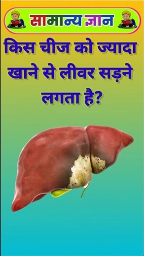 किस चीज को ज्यादा खाने से लीवर सड़ने लगता है | gk | short gk | shorts | rkj gk study | #shorts