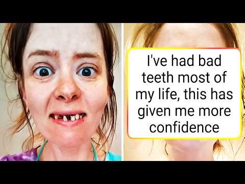 Amazing Transformations That Don’t Feel Real