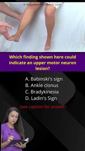 Nurse Quiz: Which Clinical Sign Shown Suggest Upper Motor Neuron Lesion #shorts