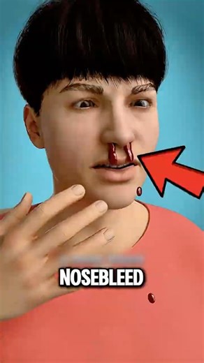 Nosebleed? Stop It Fast With This Simple Mistake-Free Trick