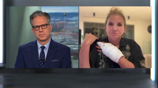 Drop Site on X: "“It was like this biblical battle where the Palestinian men … went in front of me to protect … me and my rescuers from being attacked again,” Washington Post photojournalist Heidi Levine told Jake Tapper. Levine was kicked, beaten with clubs and robbed by Israeli settlers while covering Friday’s olive harvest in the occupied West Bank, leaving her with multiple broken bones. Speaking after leaving the hospital, she said Israeli soldiers charged Palestinian farmers as settlers ad
