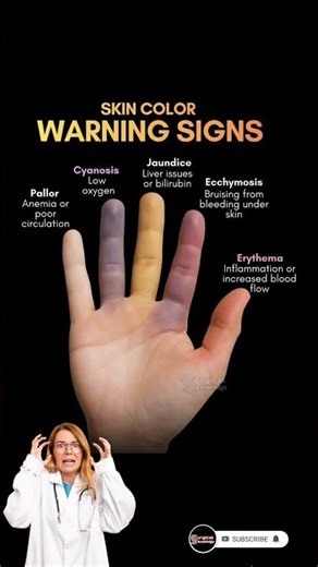 Skin Color Warning Signs #skincondition #skincolor #medical