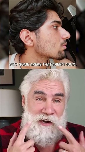 Beard of a 19-year-old.