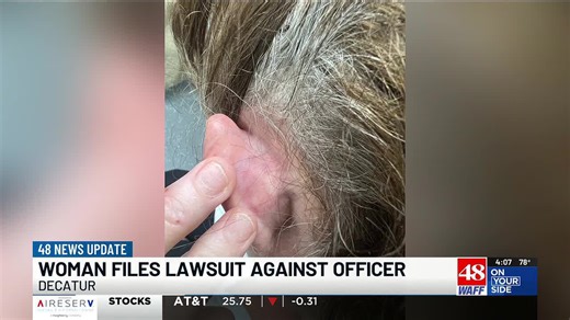 Decatur woman sues officer after arrest left her with skull fracture, brain bleed