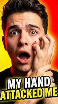 This Rare Condition Took Over My Hand 😭😨 (Real) #shorts #facts #viral